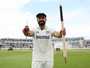 India tour of England, 2025 Manchester Test Akash Deep Arshdeep Singh injury concern